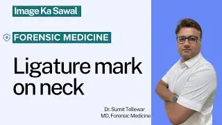 Ligature Mark On Neck | Image Ka Sawal | Dr. Sumit Tellewar | Forensic Medicine
