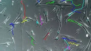 Human mesenchymal stem cells motility