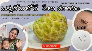 ఒక్కసారి Try  చేయండి# Best method to get rid of lice# YouTube# Bhagya's Srujana Vedika