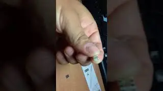Ericsson r380 how to repair poor or no signal problem