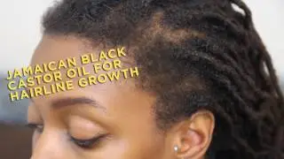 Product Review: Jamaican Black Castor Oil for Hairline Growth