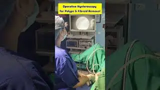 Operative Hysteroscopy for Polyps and Fibroids Removal, Hysteroscopic Polypectomy #drrakshitamalik