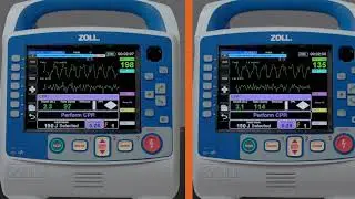 X Series&reg; Advanced: RapidShock&trade; Demonstration (English)