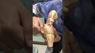 Brainstem model #neuroanatomy ospe #mbbs
