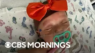Pediatric COVID hospitalizations rising nationwide