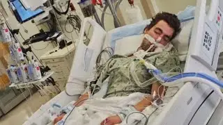 Bad accident on electric skateboard highlights safety issues