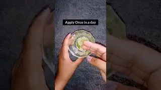 Get Rid of dark circles #shorts #ytshorts #sawistyles