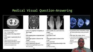 Multimodal Machine Learning in Healthcare: Concepts and Applications