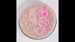 Watch E. coli Grow on MacConkey Agar &ndash; A Fascinating Microbial Journey!