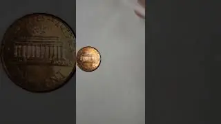 Kidney Stone Collection
