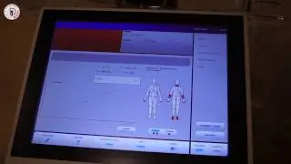 Высокотоновая терапия HiToP