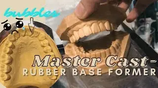 Studentist Diaries🦷: Ep. 3 Master Cast- Rubber Base Former