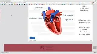 How to Share an H5P Activity in Moodle