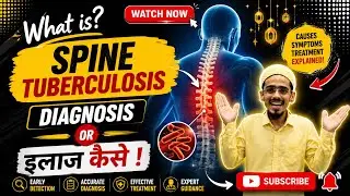 Tuberculosis of spine in hindi | Spine tuberculosis causes | Symptoms | Diagnosis | Treatment