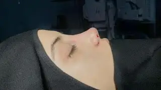 looks like you got an expensive turkish rhinoplasty👩🏼&zwj;⚕️💉 intense experimental