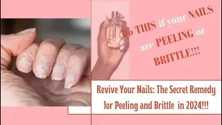 MAGIC FIX!!!: SAY GOODBYE TO BRITTLE AND PEELING NAILS #nailcaretips #nailcareroutine #blingnails✨💅
