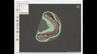 How to Hollow Dental 3D Models in Meshmixer?