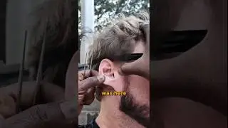 Чистка ушей на индийской улице 🇮🇳