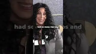 #Cher Ageless Journey: The Role of Plastic Surgery