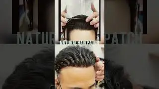 Skin Base Hair Patch System | 100% Natural Look ✨! #hairreplacement #hairsystem