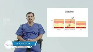 Is Liposuction or fat reduction surgery safe? (Language - Telugu)