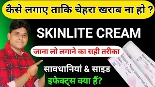 Skinlite cream review | Skinlite cream kaise use karte hain | skinlite | Skinlite cream