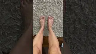 How to help hammer toe/foot pain