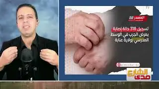 لطفي دوبل كانون | تفشي الجرب في مدارس عنابة! #صدى_الشارع #لطفي_دوبل_كانون #الجزائر #عنابة