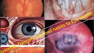 Systemic Dangers and bad habits to Eye Health.