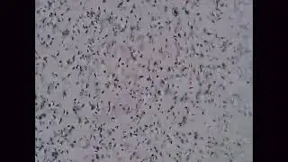 YO Home Sperm Test &ndash; Fast & Private Male Fertility Testing