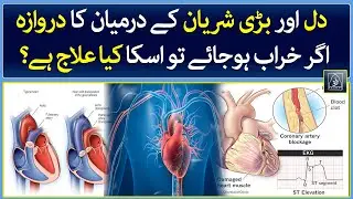What is TAVR and How does it Work? - Heart Function | Raah TV | Health | Cardiology | Lifestyle