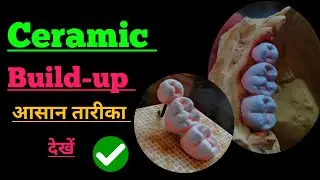 Ceramic build up Technique| How to build up ceramic| Laboratory| Ceramics| Porcelain| Anatomy| Lab