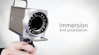 FotoFinder medicam® 1000. The new benchmark in video dermoscopy.