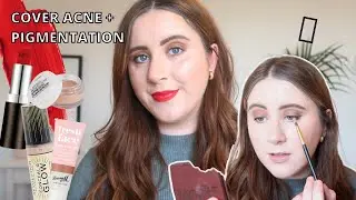 Makeup I Wear For Special Occasions | How I cover Acne + Pigmentation