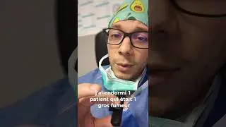 Endormir un fumeur
