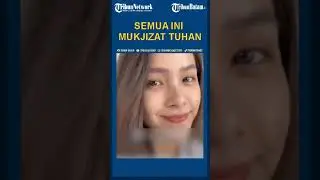 Lady Nayoan Ungkap Mukjizat Tuhan Usai Selamat dari Kecelakaan