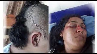 ESTOY VIVA PARA CONTARLO 😮 (TESTIMONIO DE VIDA)