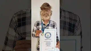 India Ka Real-life Werewolf.#werewolf #india #shockingfacts #guinnessworldrecords #facts #viralshort