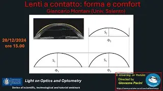 Lenti a contatto: forma e confort