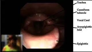 55 Hz : Upper throat, vocal cords (RIFE Healing Frequency)