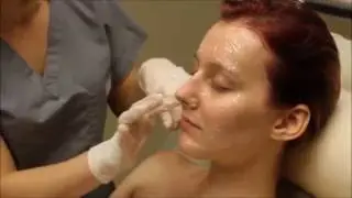 Famous Vampire Facial&reg; Revealed: Watch the full experience at Seiler Skin!