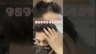 hair patch for hair growth 👀! #hairpatch #wigs #haircare #hairstyle #hairrestoration #hairsystem