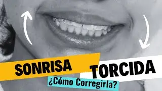 😊 SONRISA TORCIDA  ¿CÓMO CORREGIRLA?