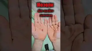 Мозоли - боль каждого гимнаста. #дети #благовещенск #тренировки #гимнастикадети #гимнаст #мотивация