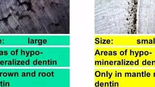 Structure of dentin | Granular layer of dentin | orbans - Jaypee