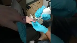 Original You Advanced Tattoo Removal...