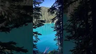 Vancouver Beautiful Places 🇨🇦 #britishcolumbia #travel #nature #bchikes #destinationbc #canada