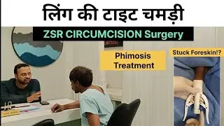 Circumcision Surgery In Bhubaneswar | ZSR Circumcision Surgery Cost In Bhubaneswar | Zenith Clinic 