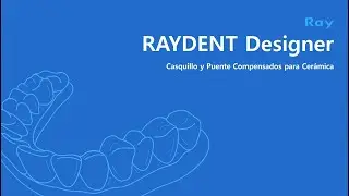 RAYDENT Designer: Casquillo y Puente Compensados para Cer&aacute;mica