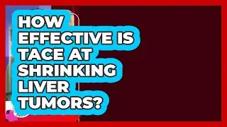 How Effective Is TACE At Shrinking Liver Tumors? - Liver Health Hub